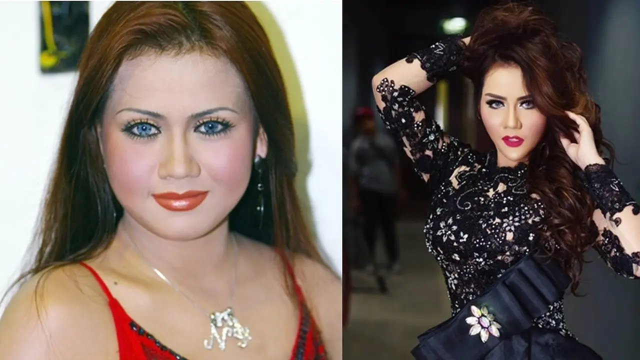 Seleb Ini Lakukan Operasi Hidung, Penampilan Terbaruya Bikin Pangling