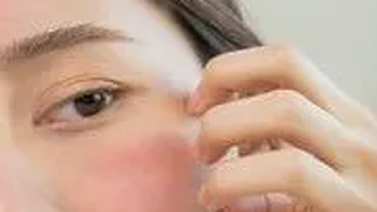 10 Jenis Rasa Gatal yang Tidak Boleh Digaruk, Bisa Bertambah Parah