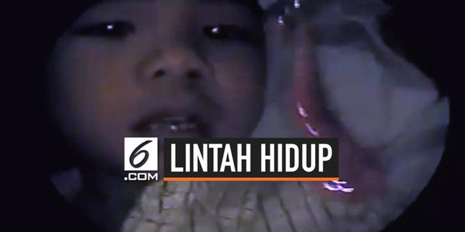 VIDEO: Dokter Temukan Lintah Hidup di Hidung Bocah 6 Tahun