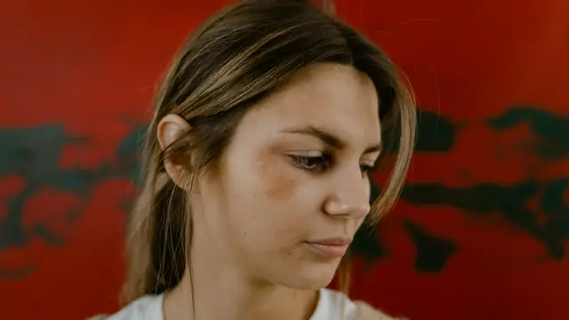 Penyebab Kaki Memar Tanpa Benturan