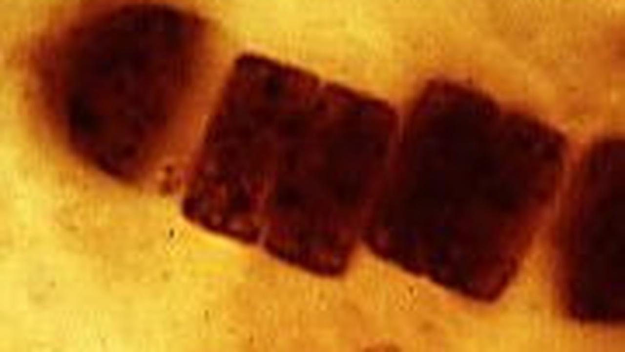 2. Penemuan Keberadaan Tilakoid Dimana Fotosintesis Terjadi<br>