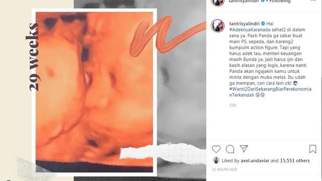 Tantri Kotak (Foto: Instagram/@tantrisyalindri)