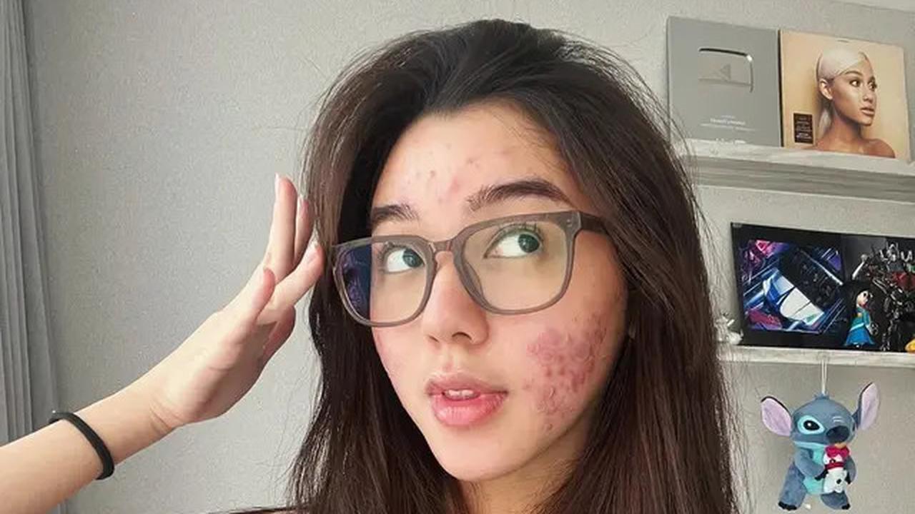 Intip Potret Terbaru Gabriella Ekaputri yang Menginspirasi untuk MencintaiDiriSendiri