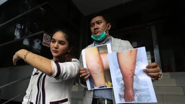 Potret Hana Hanifah saat melapor ke Polda Metro Jaya