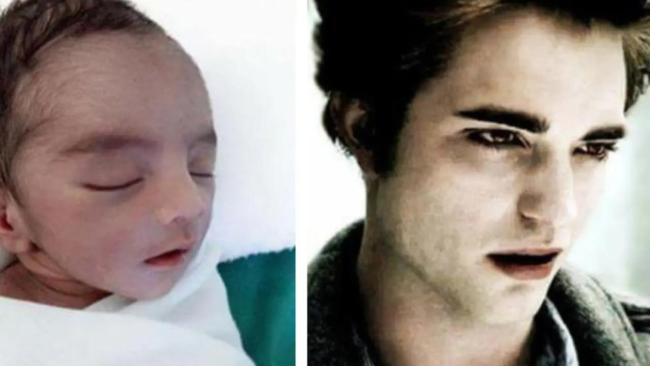 [Bintang] Punya Wajah Mirip Robert Pattinson, Bayi Ini Langsung Viral