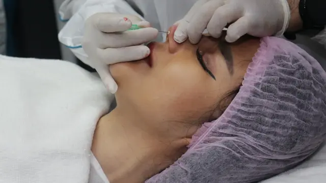 Tanam Benang Hidung