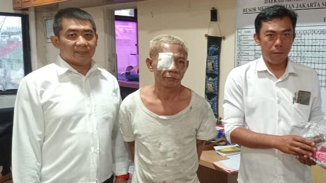 Berkaos Lusuh dan Mata Diperban, Begini Tampang Penyandera Bocah di Pospol Pejaten Village Jaksel