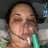 Gara-gara mengidap tumor otak, berat badan model bikini ini naik 19 kg dalam setahun. | via: thesun.co.uk