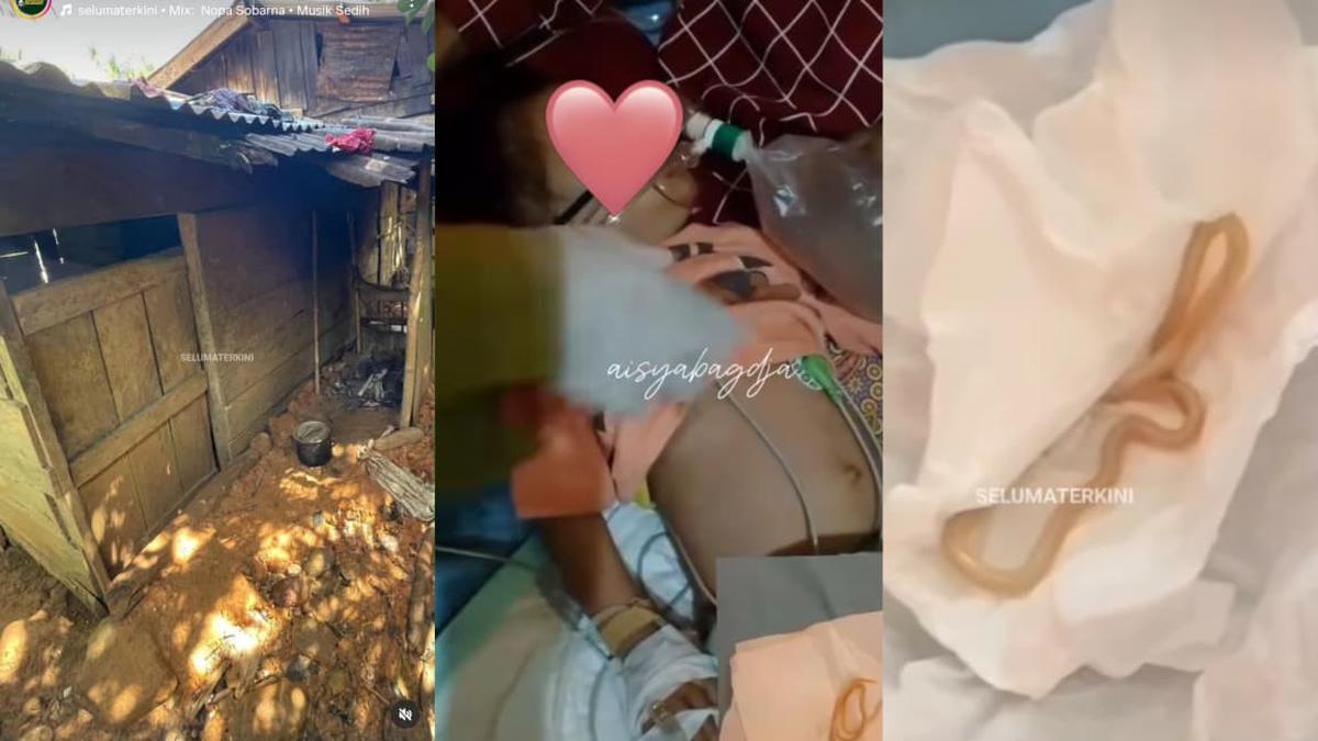 Bocah Seluma Bengkulu Keluarkan Cacing dari Mulut, Kondisi Rumah Jadi Sorotan