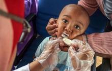 Fakta Menarik: Dinkes DIY Pastikan Kasus Cacingan Anak Terkendali dengan Cakupan Obat 99,04 Persen