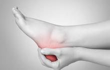 Mengalahkan Plantar Fasciitis: Tips dan Cara Penyembuhan yang Terbukti Ampuh