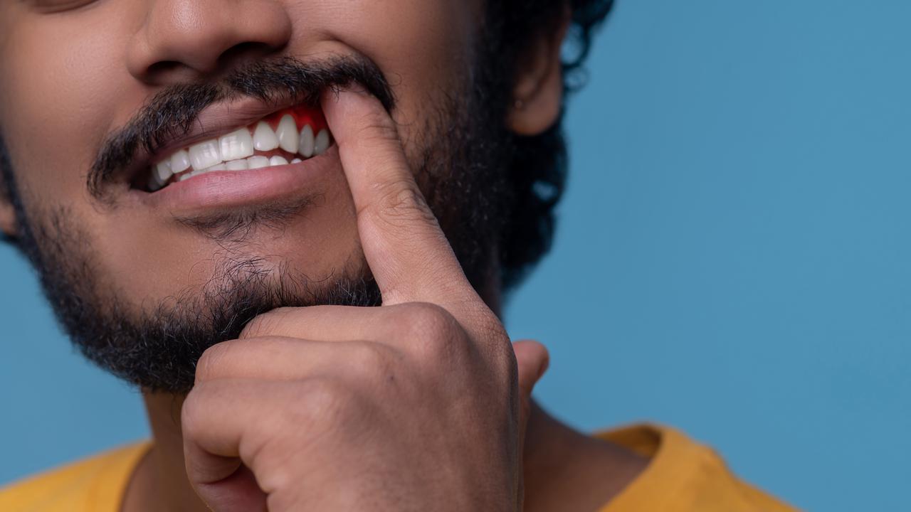 Solusi Pengobatan Alami yang Terbukti Efektif untuk Gusi Bengkak