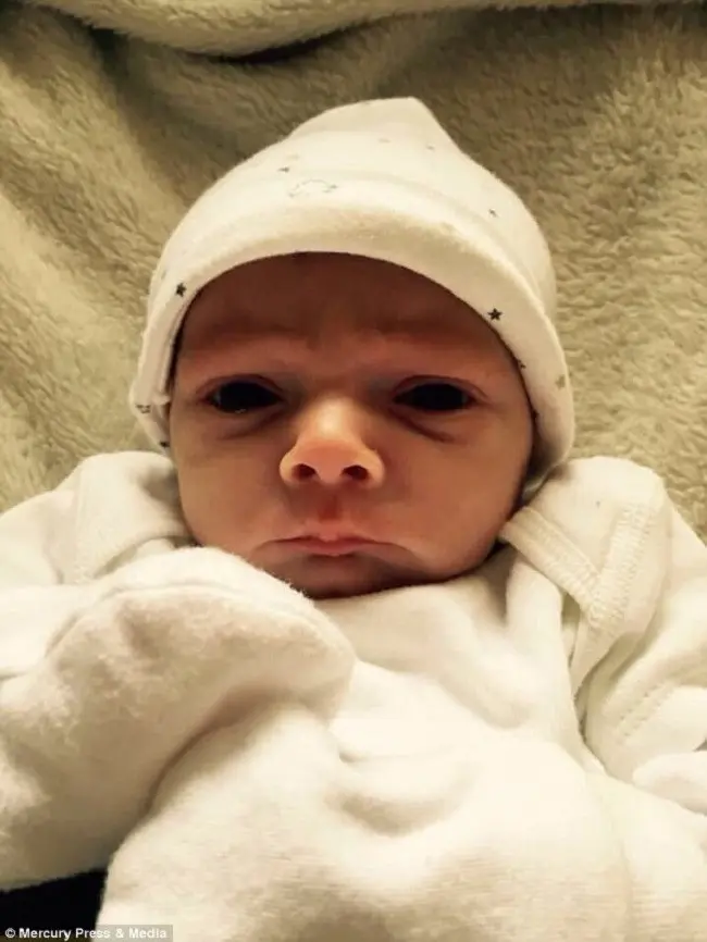 Bayi Alfie yang memiliki raut wajah pemarah. (Sumber Foto: Dailymail)