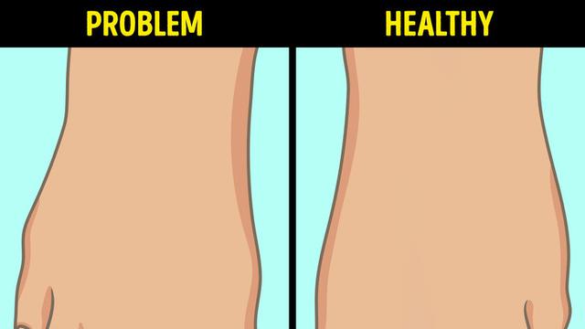 Kaki Sakit Gejala Penyakit Serius