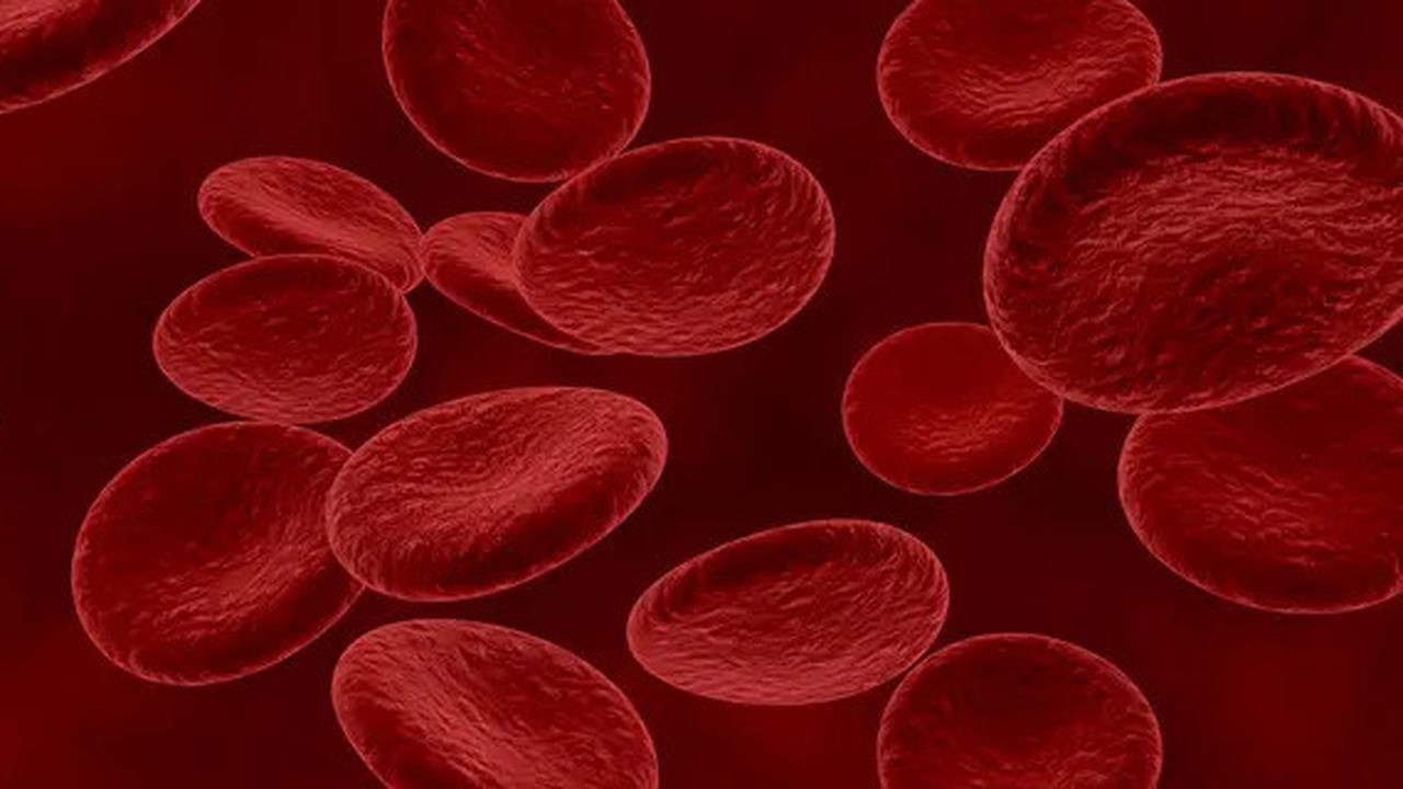Hindari 10 Jenis Makanan yang Dapat Memicu Anemia, Jangan Anggap Remeh