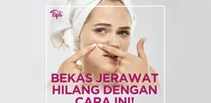 Jerawat dan bekas jerawat merupakan masalah kulit yang paling sering dialami. Nah, berikut cara menghilangkan jerawat dan bekas jerawat dalam satu hari. Simak video selengkapnya!