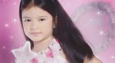 Begini potret masa kecil kekasih Alshad Ahmad yang berhasil bikin pangling. Saat masih kecil, ia terlihat menggemaskan dengan pipi tembembnya. Tiara Andini terlihat begitu imut dengan pipi tembem dan rambut panjangnya. (Liputan6.com/IG/@tiaraandini)