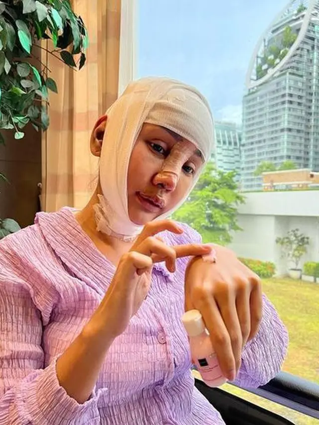 8 Potret Lucinta Luna Kembali Jalani Operasi Plastik, Curi Perhatian
