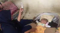 Gilang Andika, bayi laki-laki kembar siam di Batam, tubuh dan paru-parunya satu, kepalanya dua. (Foto: Ret/Batamnews)