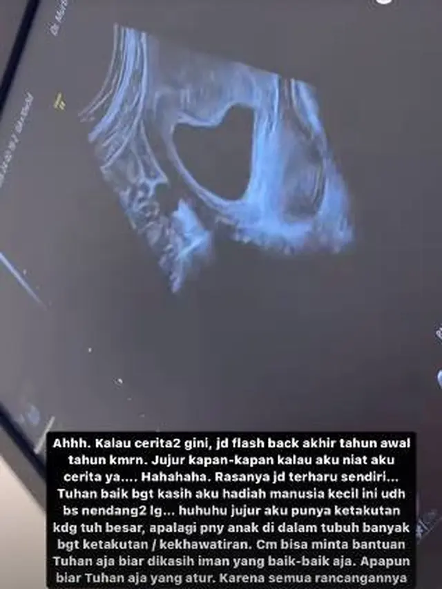 7 Potret Jonatan Christie dan Shanju Umumkan Hamil Anak Pertama, Penuh Kebahagiaan