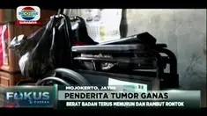 Kanker tulang yang menyerang tubuh Siti Qomariah (14) membuat lutut kaki kanannya membengkak sebesar bola sepak. Gadis kelas 2 SMP ini tidak bisa sekolah selama 5 bulan lalu.