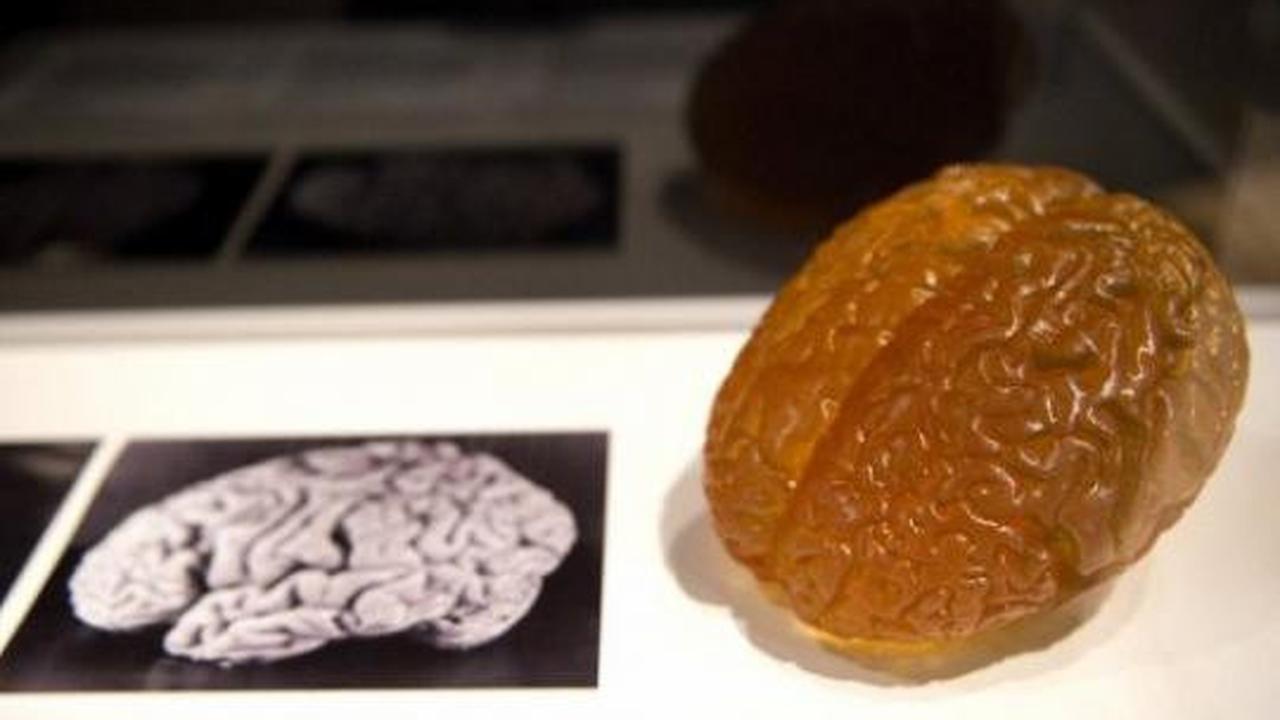 Pameran koleksi otak di London
