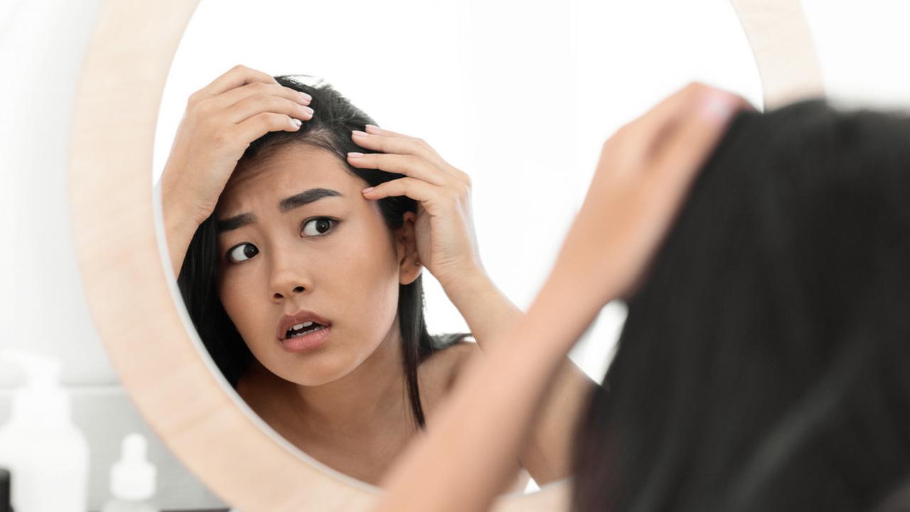 Tanda Kulit Kepala Tidak Sehat yang Nggak Boleh Diabaikan, Ada yang Pernah Dialami?