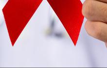 Cara Melindungi Diri dari Infeksi HIV/AIDS, Wajib Diketahui sejak Dini