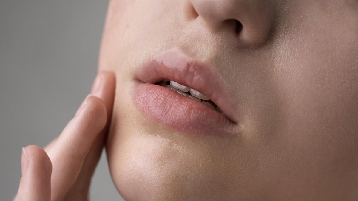 Cara Sederhana Merawat Bibir agar Lembab dan Tidak Pecah-Pecah