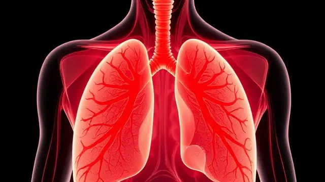 Begini Kondisi Paru-Paru Saat Terserang Pneumonia Menurut Dokter