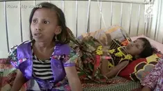 Kakak beradik ini mengidap penyakit aneh. Keduanya tidak bisa terkena sinar matahari, dan berat badannya turun merosot jauh.