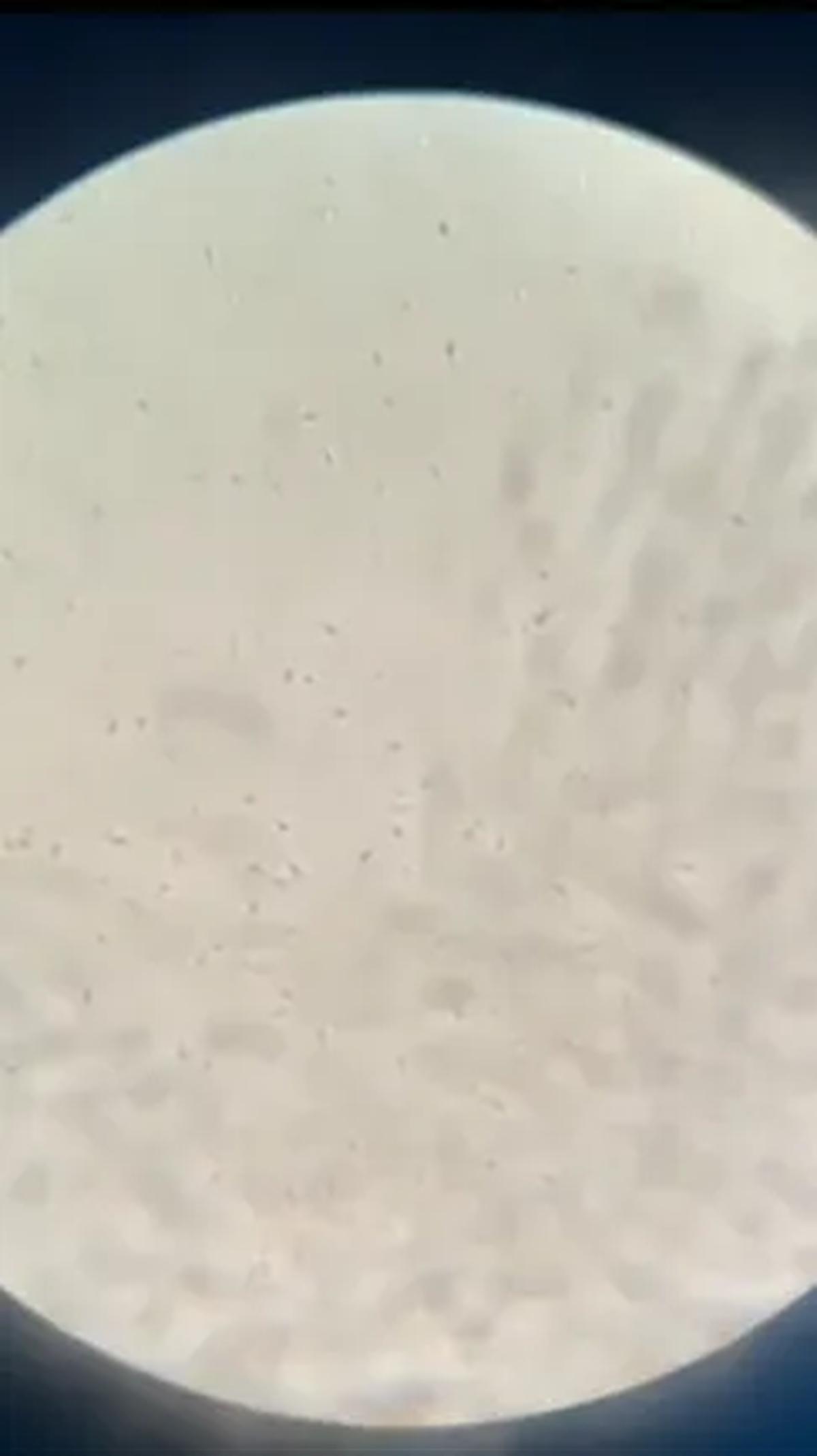 Akan tetapi, masih ada beberapa orang yang awam dengan penampakan sel sperma yang sebenarnya. <br>