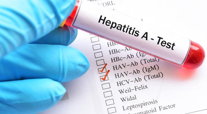 Penyebab Hepatitis (sumber: iStock)