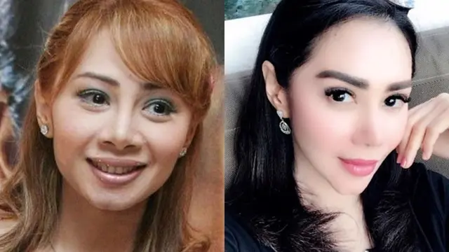Seleb Ini Lakukan Operasi Hidung, Penampilan Terbaruya Bikin Pangling