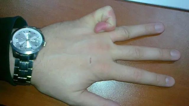 6 Aksi Nyeleneh Orang Kalau Punya Tangan Lentur Ini Bikin Heran