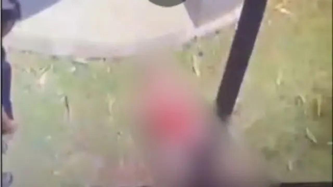 Kondisi Terkini Bocah yang Alami Koma Usai Kesetrum Akibat Dibully