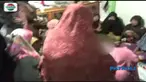 Terdapat luka cakar di bagian leher dan wajah korban.