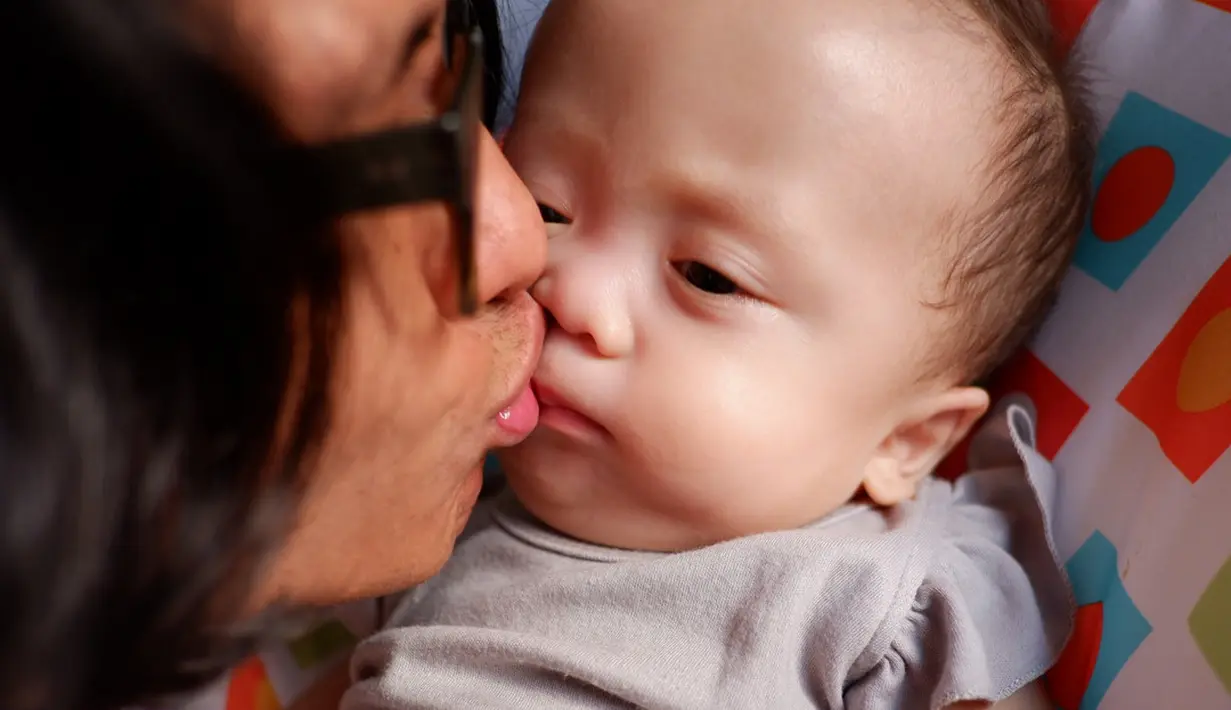 "Kita sampe jual mobil untuk Zio. Banyak hal yang kami korbankan juga sih. Beberapa tunggakan juga terjadi di keluarga kita. Tapi kita tetap happy untuk semua, kalau sampai harus jual rumah, akan kita jual," Raditya. (Instagram/joannaalexandra)