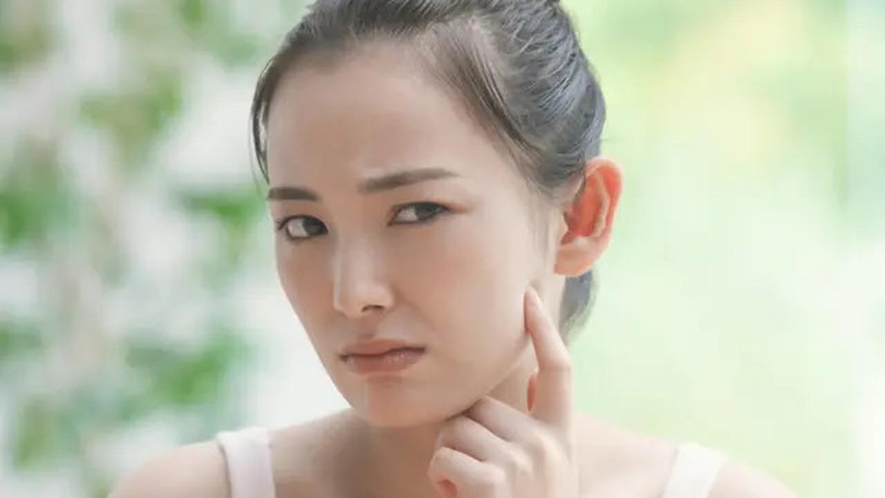 Cara Menghilangkan Hiperpigmentasi Bekas Jerawat dengan Bahan Alami dari Dapur, Coba Kombinasi Madu dan Buah Ini