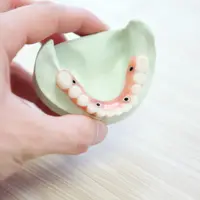 Ilustrasi gigi berlubang.Copyright unsplash.com/Matthew Poetker