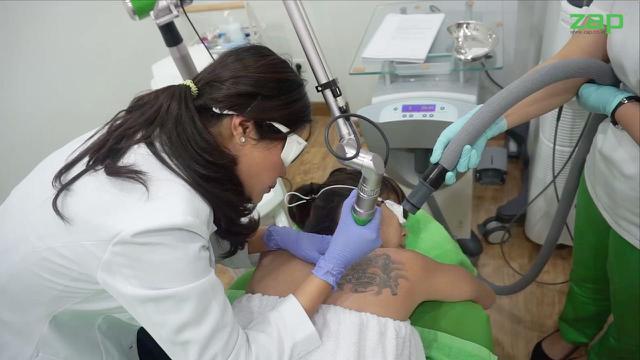 Tren Menghapus Tato dengan Laser