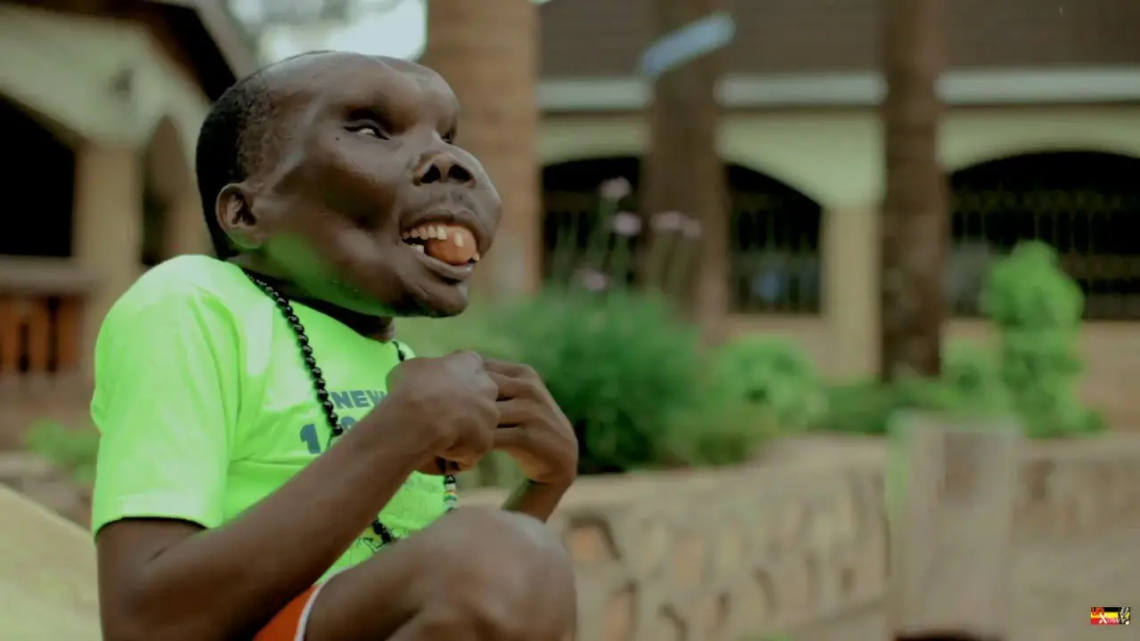 Kisah Cinta Godfrey Baguma, 'The Ugliest Man' di Uganda