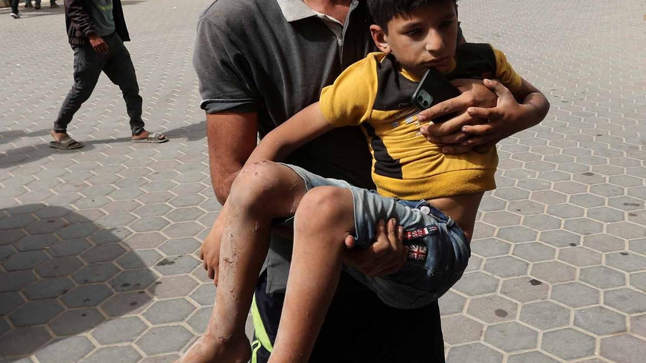 FOTO: Pilu! Anak-Anak Korban Serangan Udara Israel