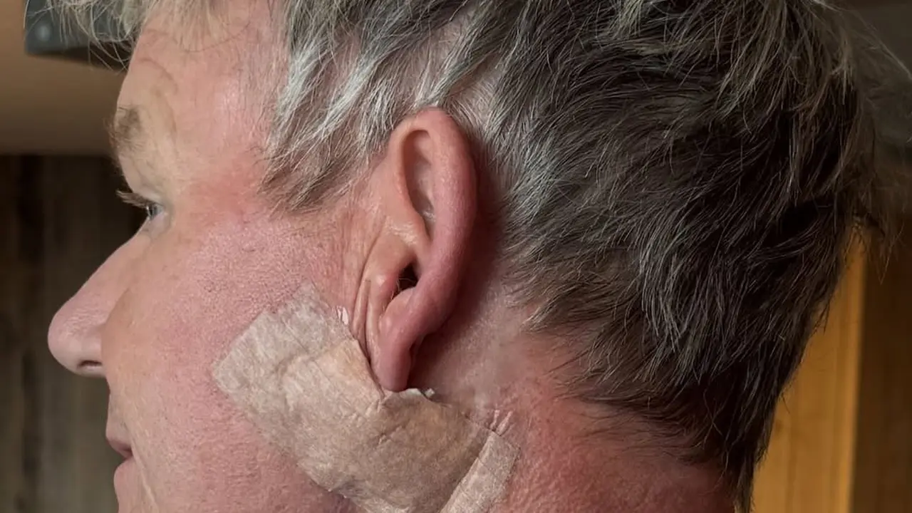 Chef Gordon Ramsay Ungkap Mengidap Kanker Kulit, Ingatkan Publik Rutin Pakai Sunscreen