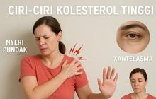 Jangan Sepelekan! Ini Ciri-Ciri Kolesterol Tinggi yang Terlihat di Pundak