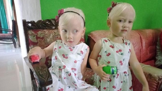 Viral Anak Kembar Bule Asli Wonogiri, Orangtua Suka Dikira ...