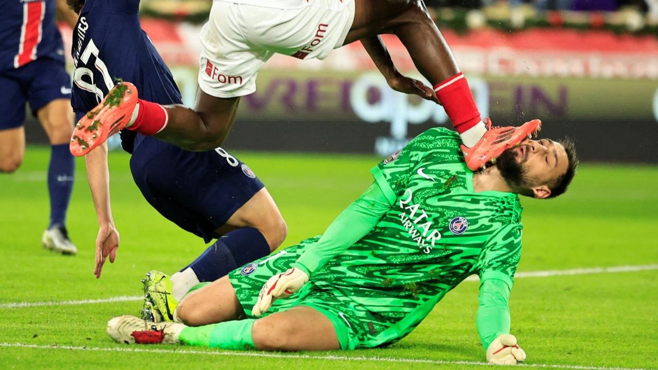 FOTO: Ngeri! Begini Kondisi Wajah Donnarumma Berdarah-darah Usai Tendangan Horor Wilfried Singo