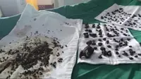 Batu yang dikeluarkan dari perut wanita dalam sebuah operasi oleh tim ahli bedah di China. 