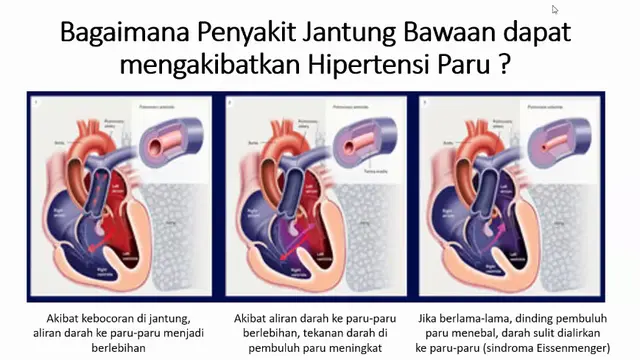 Pfizer Media Health Forum