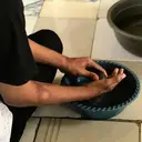 Kusta Bukan Penyakit Kutukan, Bisa Disembuhkan